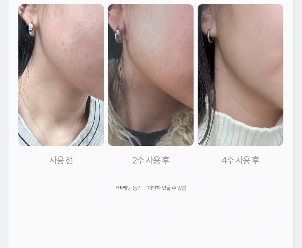 [멜라제로/11가지 비타민 미백케어]가쉬 10초 마이크로 버블팩 퍼펙트 멜라제로 150회분 상세페이지 60